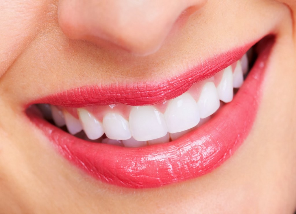 Phương pháp niềng răng invisalign cho hàm răng thẩm mỹ