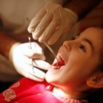 Có nên nhổ răng thừa không, nhổ rồi có biến chứng không?