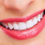 Phương pháp niềng răng invisalign cho hàm răng thẩm mỹ