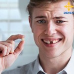 Quy trình trồng răng giả như thế nào để thay thế răng gãy