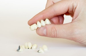 Chia sẻ cách trồng răng sứ bền đẹp nên biết dành cho người mất răng