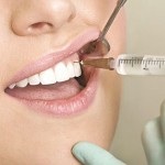 Nhổ răng để NIỀNG có đau không khi thực hiện tại nha khoa Kim