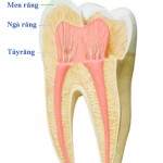 Phương pháp điều trị tủy răng hiệu quả hiện nay